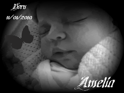 Intrahepatic+cholestasis+of+pregnancy+icp